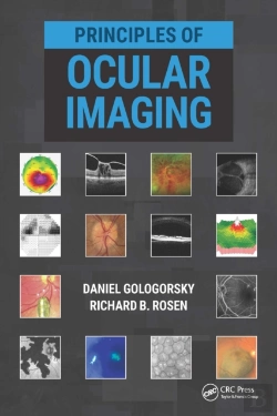 Bertrand.pt - Principles Of Ocular Imaging