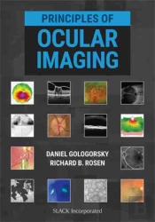 Principles Of Ocular Imaging
