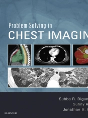 Problem Solving In Chest Imaging E-Book