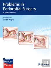 Problems In Periorbital Surgery
