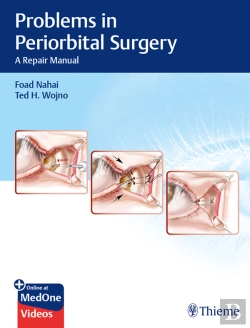 Bertrand.pt - Problems In Periorbital Surgery