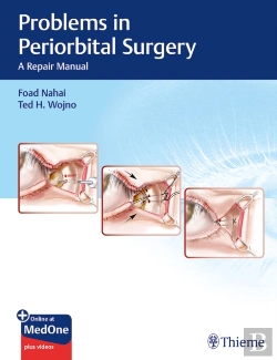 Bertrand.pt - Problems In Periorbital Surgery