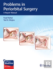 Problems In Periorbital Surgery