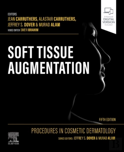 Bertrand.pt - Procedures In Cosmetic Dermatology: Soft Tissue Augmentation