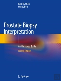 Bertrand.pt - Prostate Biopsy Interpretation