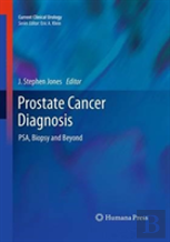 Prostate Cancer Diagnosis