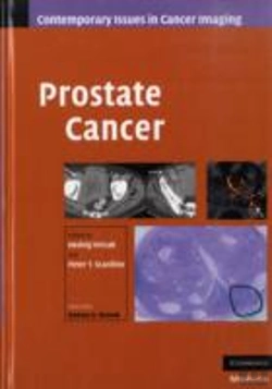 Bertrand.pt - Prostate Cancer