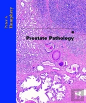 Prostate Pathology