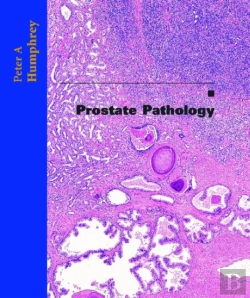 Bertrand.pt - Prostate Pathology
