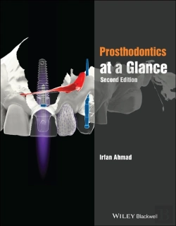 Bertrand.pt - Prosthodontics At A Glance