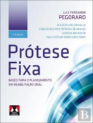 Prótese Fixa