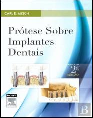 Prótese sobre Implantes Dentais
