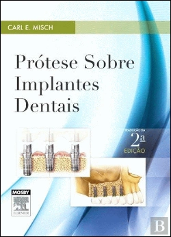 Bertrand.pt - Prótese sobre Implantes Dentais