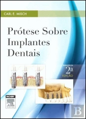 Prótese sobre Implantes Dentais