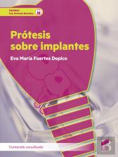 Protesis Sobre Implantes Contenido Actualizado