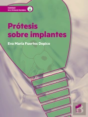 Prótesis Sobre Implantes