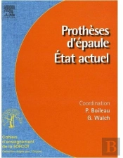 Prothèse D'Épaule ; État Actuel