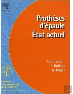 Bertrand.pt - Prothèse D'Épaule ; État Actuel