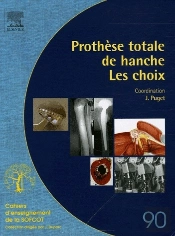 Prothese Totale De Hanche