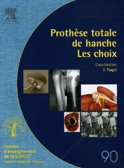 Bertrand.pt - Prothese Totale De Hanche