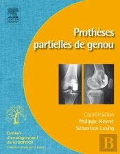 Prothèses Partielles Du Genou
