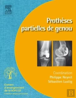 Bertrand.pt - Prothèses Partielles Du Genou