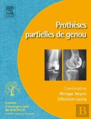 Prothèses Partielles Du Genou