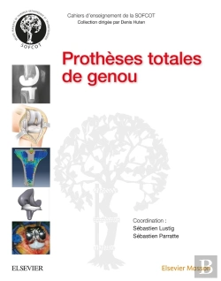 Bertrand.pt - Prothèses Totales De Genou