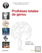 Prothèses Totales De Genou