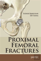 Proximal Femoral Fractures