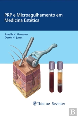 Bertrand.pt - Prp E Microagulhamento Em Medicina Estética