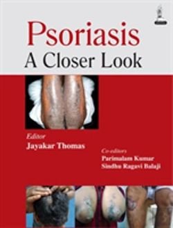 Bertrand.pt - Psoriasis