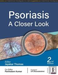 Psoriasis