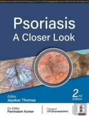 Psoriasis