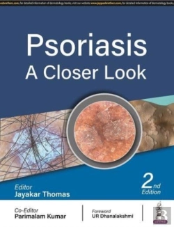 Bertrand.pt - Psoriasis