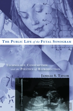 Bertrand.pt - Public Life Of The Fetal Sonogram
