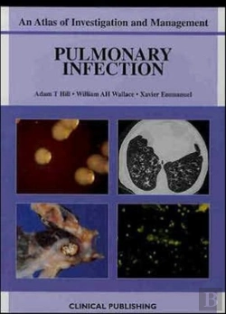 Bertrand.pt - Pulmonary Infection