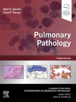 Bertrand.pt - Pulmonary Pathology E-Book