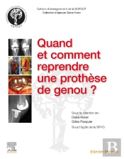 Quand Et Comment Reprendre Une Prothèse De Genou ?