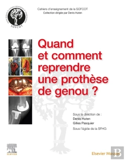 Bertrand.pt - Quand Et Comment Reprendre Une Prothèse De Genou ?