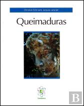 Queimaduras