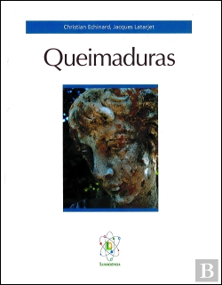 Bertrand.pt - Queimaduras