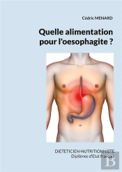 Quelle Alimentation Pour L'Oesophagite ? - - - Illustrations, Couleur