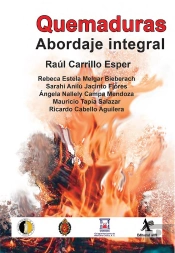 Quemaduras. Abordaje Integral