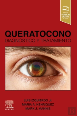 Bertrand.pt - Queratocono