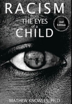 Bertrand.pt - Racism From The Eyes Of A Child