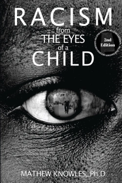 Bertrand.pt - Racism From The Eyes Of A Child