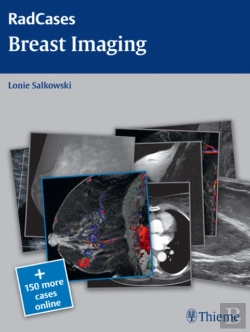 Bertrand.pt - Radcases Breast Imaging