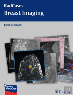 Bertrand.pt - Radcases Breast Imaging