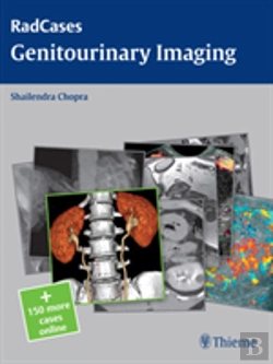 Bertrand.pt - Radcases Genitourinary Imaging